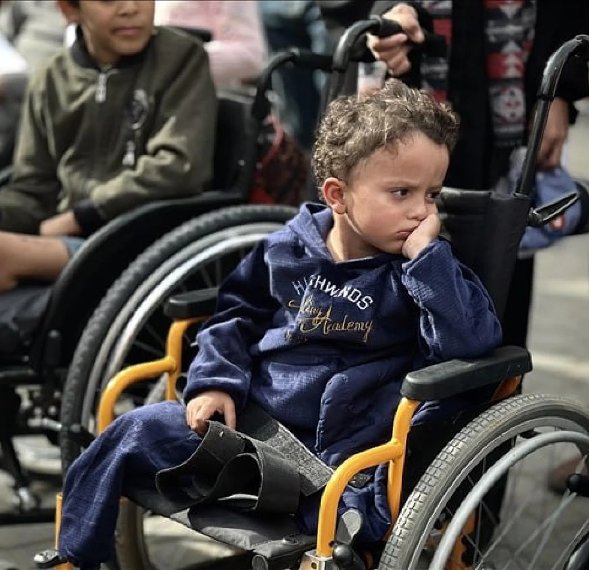 Gazze, Dünyada Nüfusa Oranla En Fazla Ampute Çocuğun Yaşadığı Bölge Oldu