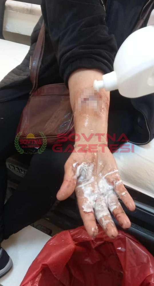 Pitbull cinsi köpek kadına saldırdı